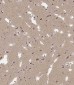 ADAMTS17 Antibody (Center)