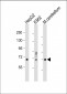 TCF4 Antibody (N-term)