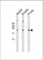 NRAS Antibody (N-term)