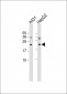 NRAS Antibody (N-term)