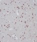 BRAF Antibody (T400)