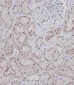 BRAF Antibody (T400)