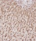 GUSB Antibody (Center)