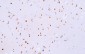 ATRX Antibody