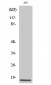 Cleaved-Caspase-3 p17 (D175) Polyclonal Antibody