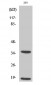 Cleaved-Caspase-6 p18 (D179) Polyclonal Antibody