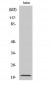 Cleaved-Caspase-7 p20 (D198) Polyclonal Antibody