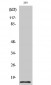 Cleaved-Caspase-7 (S199) Polyclonal Antibody