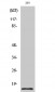 Cleaved-Caspase-7 (S199) Polyclonal Antibody