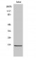 Cleaved-Caspase-2 p18 (G170) Polyclonal Antibody