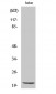 Cleaved-Caspase-7 p20 (D198) Polyclonal Antibody