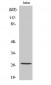 Cleaved-Cathepsin C HC (R394) Polyclonal Antibody