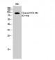 Cleaved-COL1A2 (G1102) Polyclonal Antibody