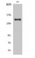 Cleaved-COL4A3 (L1425) Polyclonal Antibody