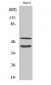 Cleaved-MMP-10 (F99) Polyclonal Antibody