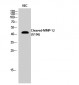 Cleaved-MMP-12 (G106) Polyclonal Antibody