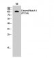 Cleaved-Notch 1 (V1754) Polyclonal Antibody