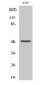 Cleaved-Factor X/ Factor X LC (A41) Polyclonal Antibody