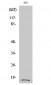 Cleaved-Integrin α5 LC (E895) Polyclonal Antibody