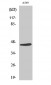 Cleaved-MASP-1 HC (R448) Polyclonal Antibody