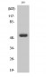MMP-1 Polyclonal Antibody