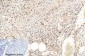 Cleaved-PARP-1 (D214) Polyclonal Antibody