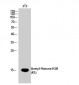 Histone H2B (Acetyl Lys5) Polyclonal Antibody
