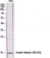 Histone H2B (Acetyl Lys5) Polyclonal Antibody