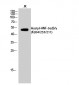 HNF-3α/β/γ (Acetyl Lys264/253/211) Polyclonal Antibody