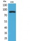 HSP 90 (Acetyl Lys292/284) Polyclonal Antibody