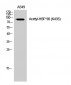 HSP 90 (Acetyl Lys435) Polyclonal Antibody