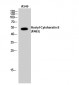 Cytokeratin 8 (Acetyl Lys483) Polyclonal Antibody