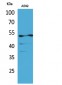 Cytokeratin 8 (Acetyl Lys483) Polyclonal Antibody