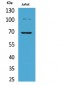 Ku-70 (Acetyl Lys542) Polyclonal Antibody