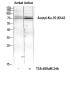 Ku-70 (Acetyl Lys542) Polyclonal Antibody