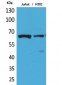 NFκB-p65 (Acetyl Lys218) Polyclonal Antibody