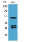 p53 (Acetyl Lys370) Polyclonal Antibody