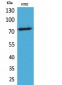 p73 (Acetyl Lys321) Polyclonal Antibody