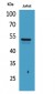 Tubulin α (Acetyl Lys40) Polyclonal Antibody