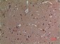 Tubulin α (Acetyl Lys40) Polyclonal Antibody