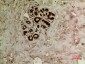 Tubulin α (Acetyl Lys40) Polyclonal Antibody