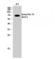 Ku-70 (Acetyl Lys331) Polyclonal Antibody