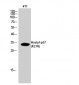 p57 (Acetyl Lys278) Polyclonal Antibody