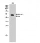 p53 (Acetyl Lys373) Polyclonal Antibody