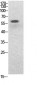 NFκB-p65 (Acetyl Lys314/Lys315) Polyclonal Antibody