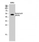 p53 (Acetyl Lys320) Polyclonal Antibody