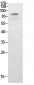 PCAF (Acetyl Lys428) Polyclonal Antibody