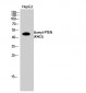 PTEN (Acetyl Lys402) Polyclonal Antibody