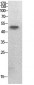 PTEN (Acetyl Lys402) Polyclonal Antibody