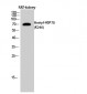HSP70 (Acetyl Lys246) Polyclonal Antibody